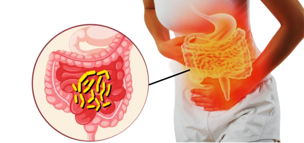 वीरगन्जमा हैजा : संक्रमितको संख्या ९३ पुग्यो, नियन्त्रणमा चुनौती
